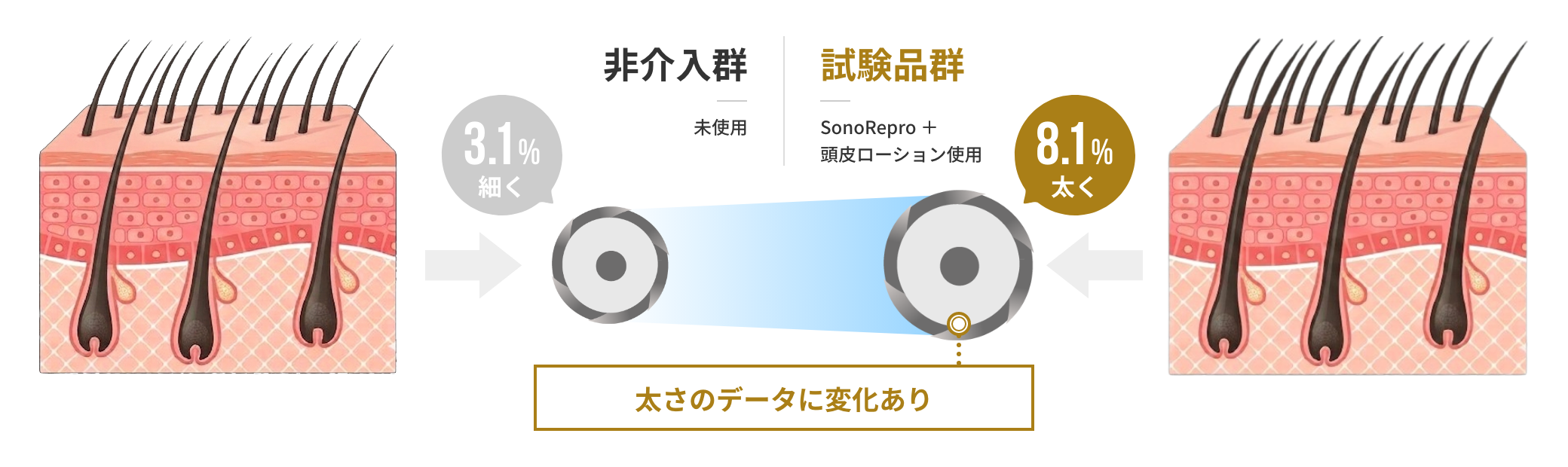 毛髪径の変化