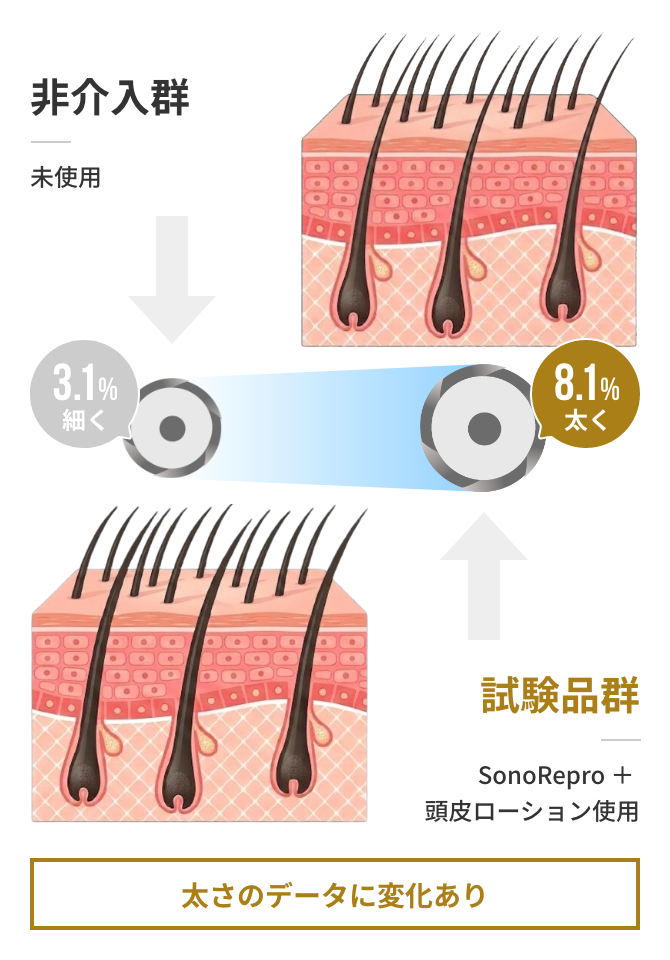 毛髪径の変化