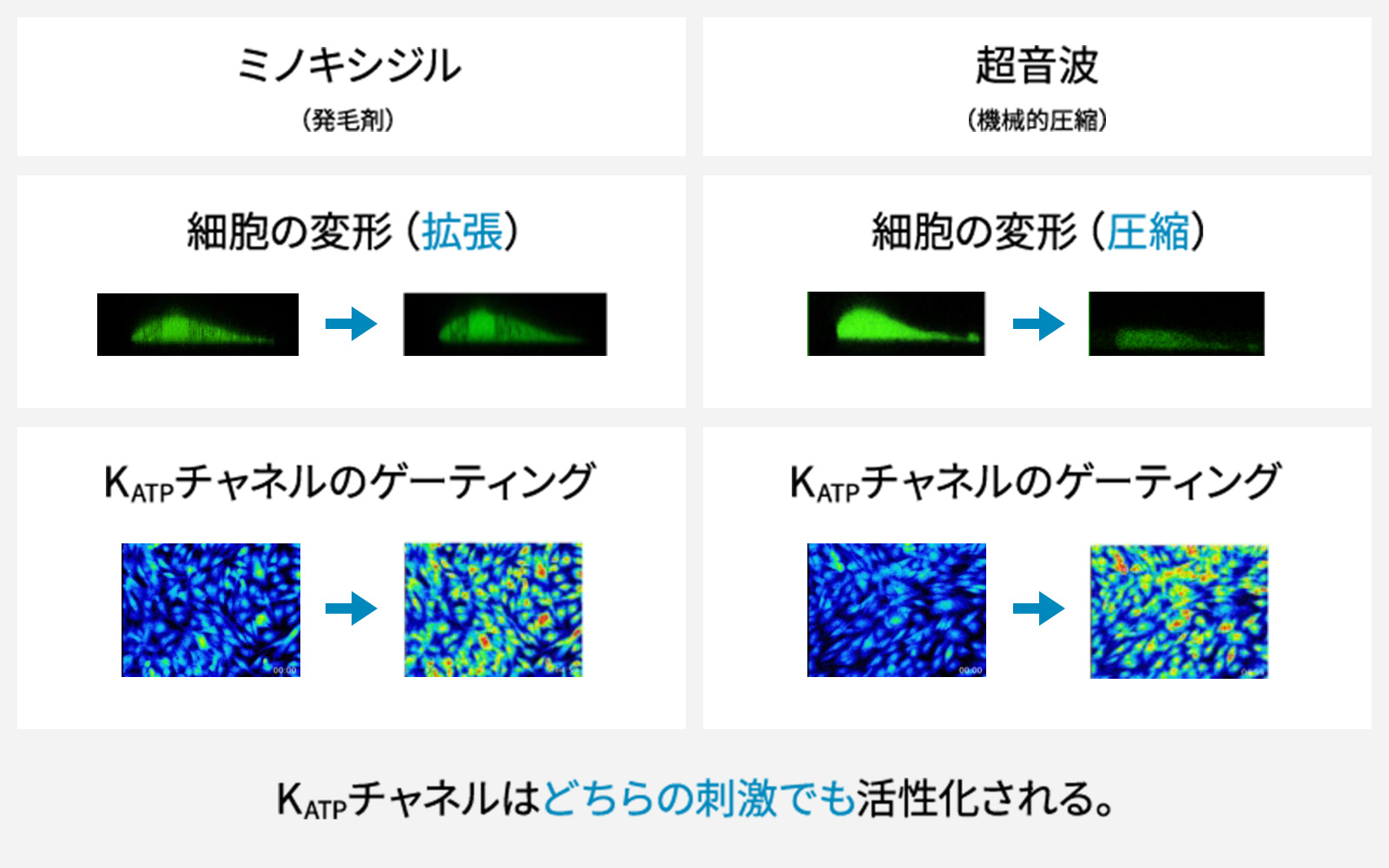 ミノキシジルと超音波による機械的刺激による効果比較